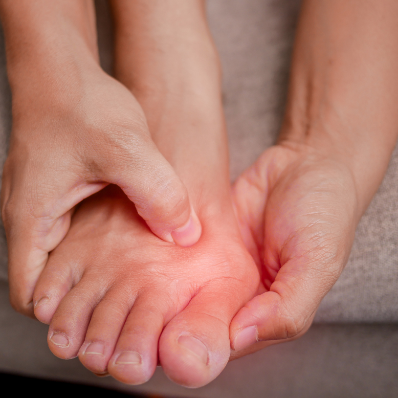 Hallux Valgus : comprendre les vraies causes et les solutions naturelles pour soulager vos pieds